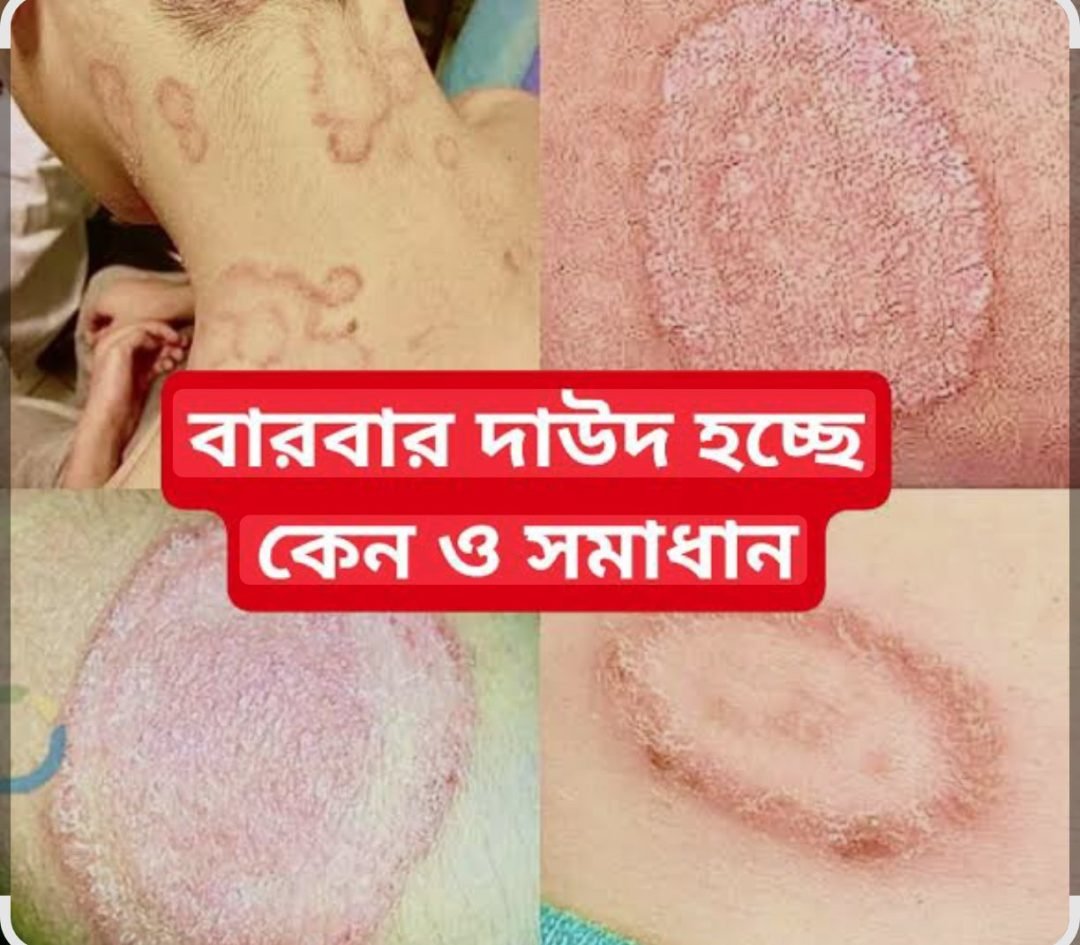 প্রাচীন চার্ম কেয়ার